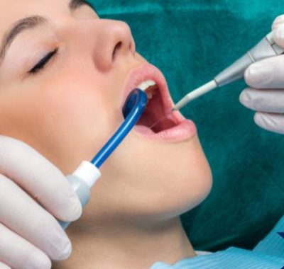importancia de hacerse una limpieza dental